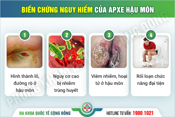 Đa khoa Quốc tế Cộng Đồng: Khám chữa áp xe hậu môn hóa ra lại dễ dàng hơn bạn nghĩ!