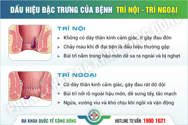 Cảnh Báo Mức Độ Nguy Hiểm Lòi Búi Trĩ Cần Thăm Khám Ngay