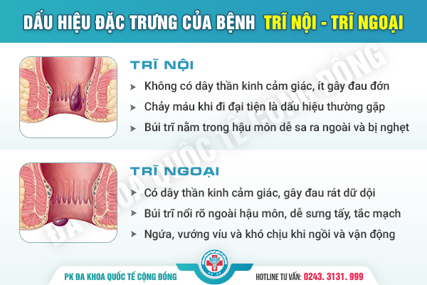 Điều Trị Lòi Dom Không Cần Phẫu Thuật – Giải Pháp Mới Giúp Người Bệnh An Tâm
