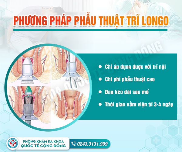 Phương pháp cắt trĩ longo có dễ tái phát không?