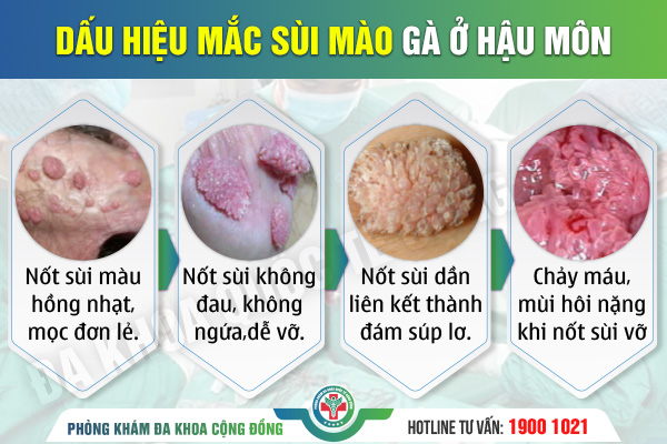 Tác hại khôn lường của biểu hiện đau hậu môn