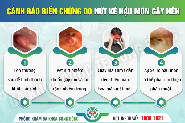 Tại sao bị nứt kẽ hậu môn? 5 nguyên nhân thường gặp nhất