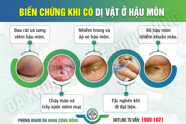 Dị vật ở hậu môn ảnh hưởng như thế nào đến cuộc sống