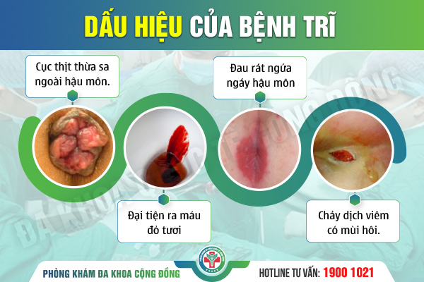 Chữa trĩ bằng phương pháp Laser: “Cứu tinh” cho người sợ phẫu thuật