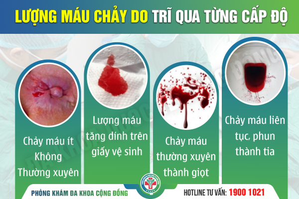 Chảy nhiều máu do trĩ nên khám ở đâu? Top 3 địa chỉ chữa bệnh trĩ ra máu uy tín tại miền Bắc