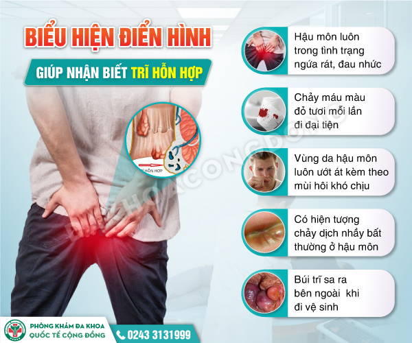 Nguyên nhân và cách chữa trĩ hỗn hợp hiệu quả