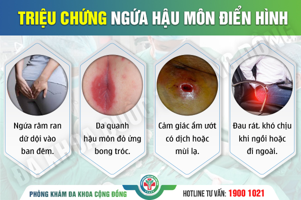 Ngứa hậu môn: Chuyện tưởng nhỏ nhưng phiền toái khó lường